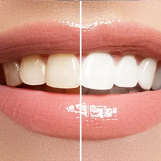 Bleaching